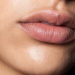 Adjust Your Lips Using The Lip Filler Process